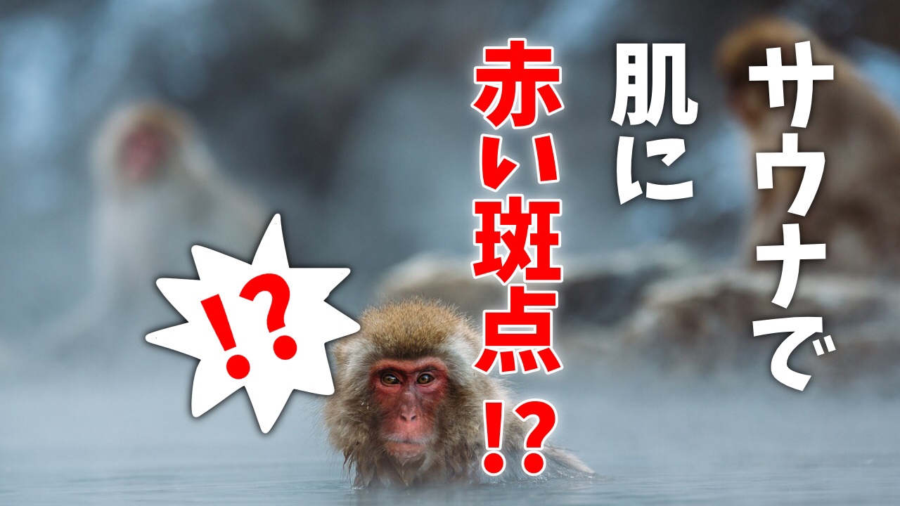 サ道 サウナで肌に赤い斑点が出現 まだら模様の正体 あまみ って 体に悪いの ムッカラーナ通信 うしと かえると 山登り サ道 サウナで肌に赤い斑点が出現 まだら模様の正体 あまみ って 体に悪いの ムッカラーナ通信 うしと かえると 山登り